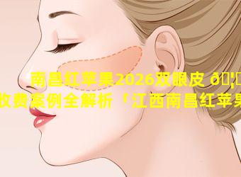 南昌红苹果2026双眼皮 🦉 收费案例全解析「江西南昌红苹果美容医院 🐈 」